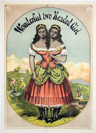 Millie-Christine 2-Headed Girl Poster