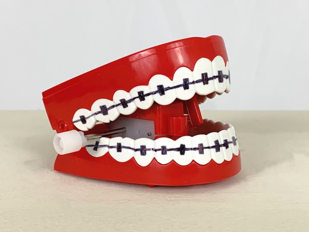 Braces 1000 x 750